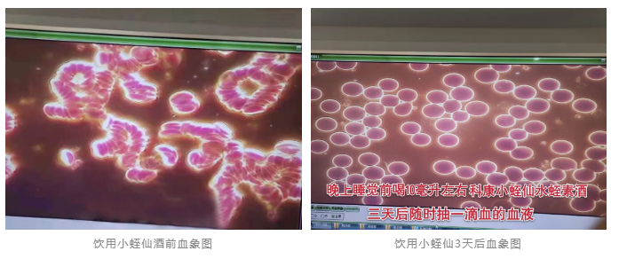 水蛭素、小蛭仙酒、醬香水蛭酒