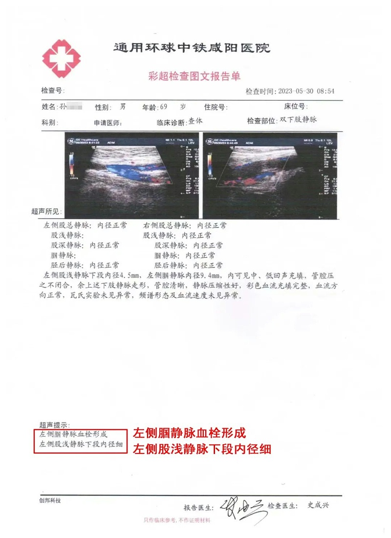 水蛭素、水蛭素膠囊、壯醫(yī)水蛭療法