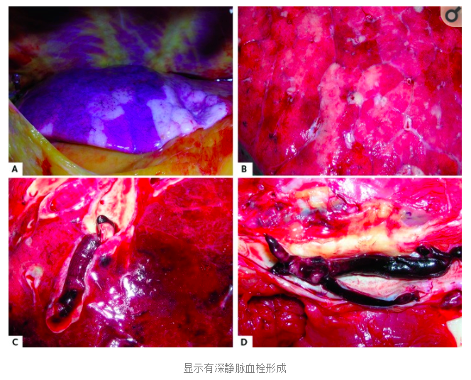 水蛭素、陽康、烏梅、壯醫(yī)水蛭療法