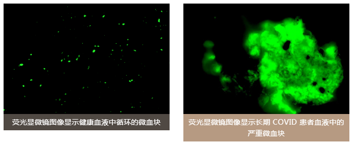 水蛭素、陽康、烏梅、壯醫(yī)水蛭療法