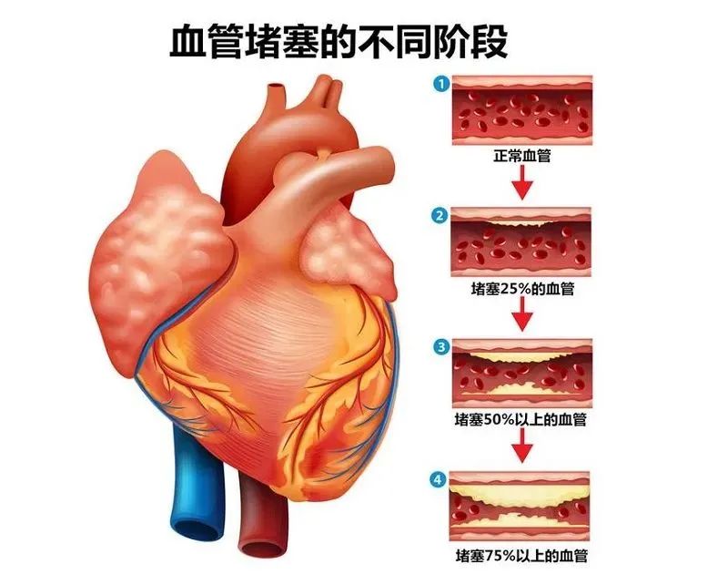 壯醫(yī)水蛭療法，天然水蛭素